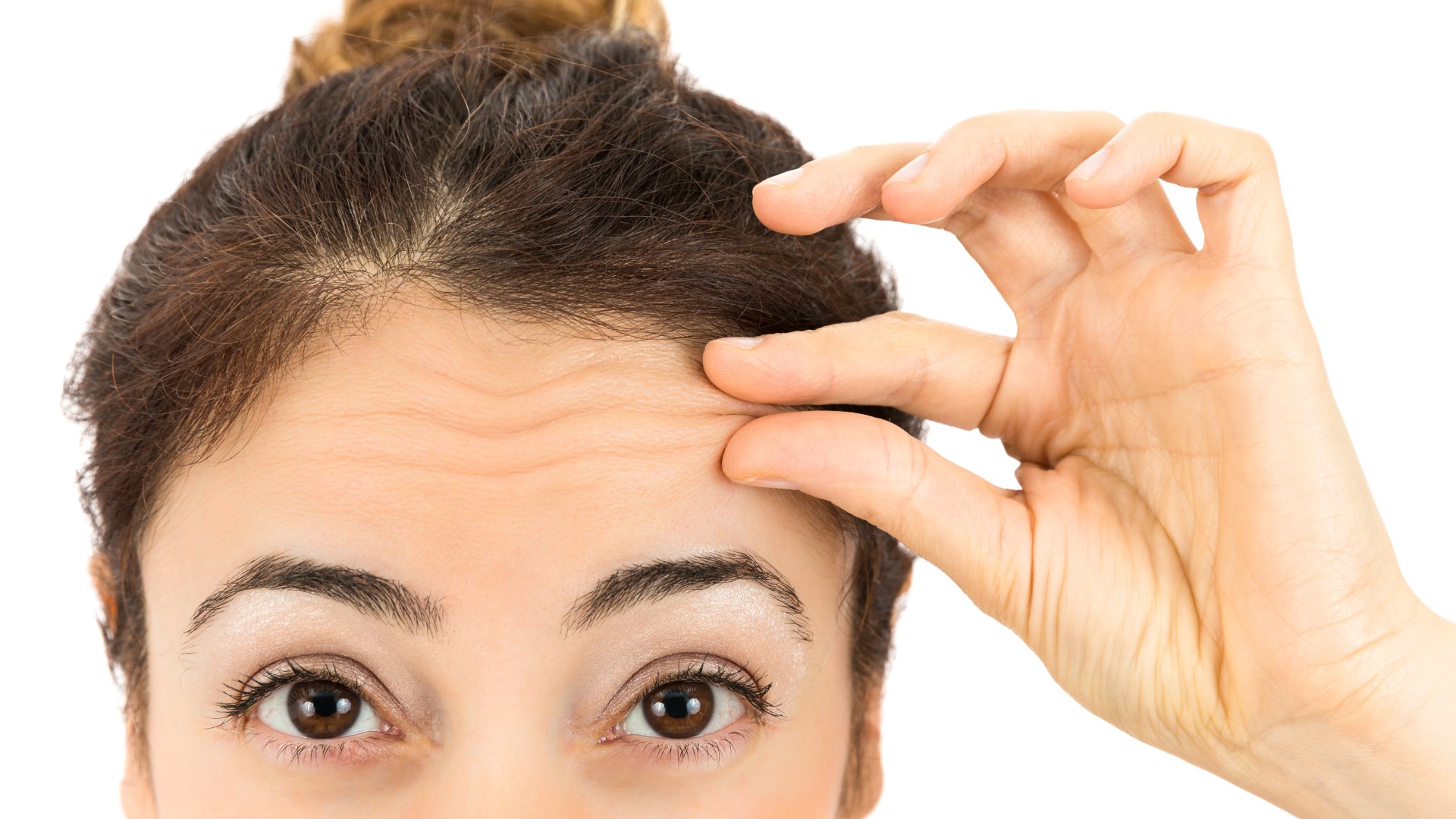 Cómo combatir las arrugas de expresión con el uso de neuromoduladores